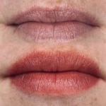 Lip blush tattooing before and after